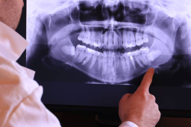 Best Emergency Tooth Extraction in Lemmon Valley, NV