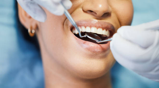Best Emergency Dental Care for Broken or Chipped Teeth in Lemmon Valley, NV